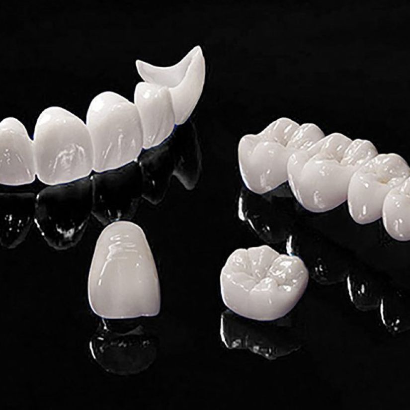Răng Sứ HT Smile 